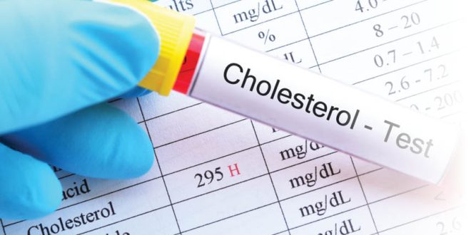 چرا کلسترول خون شما بالا می رود؟